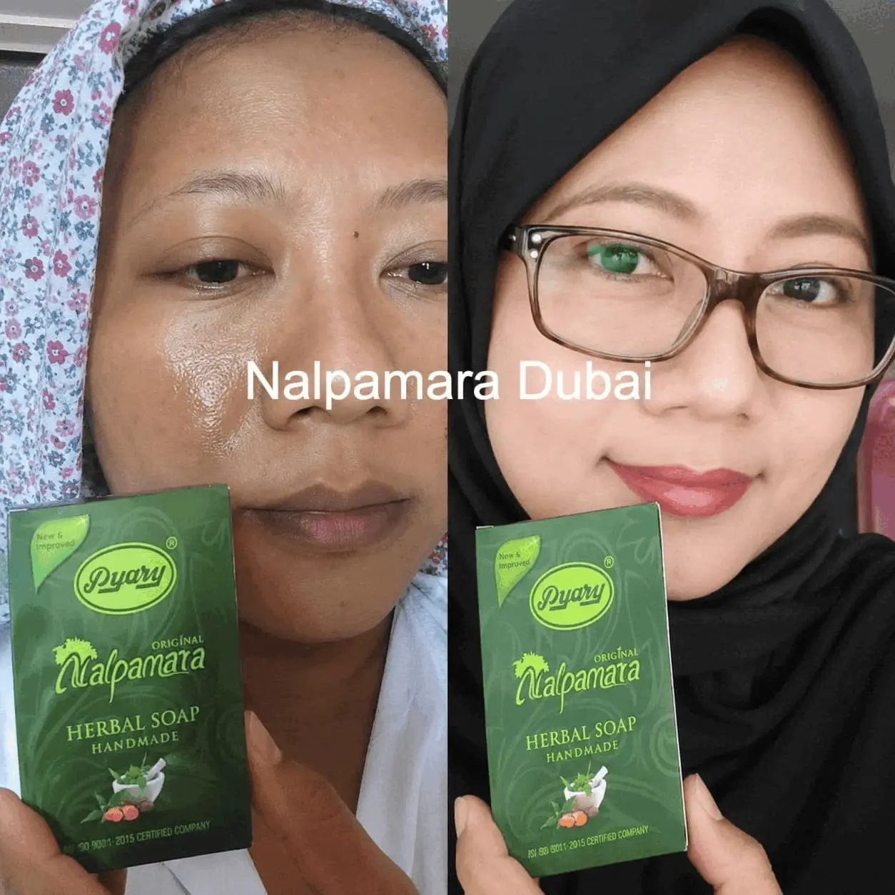 Before After Flek Hitam
