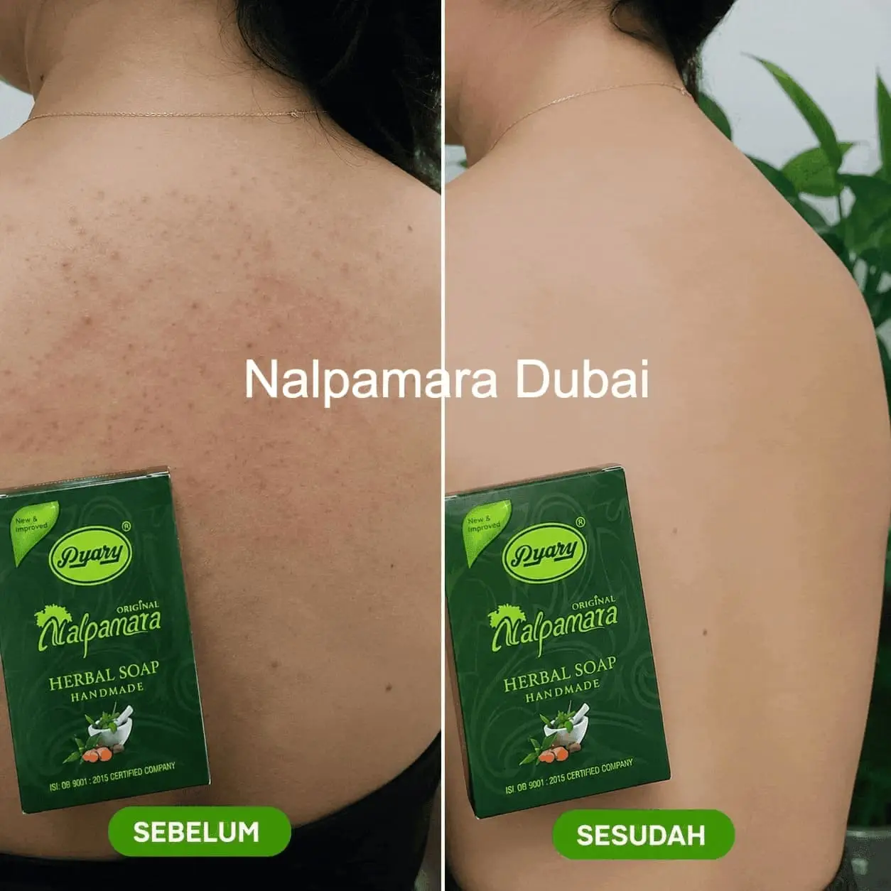 Before After Gatal
