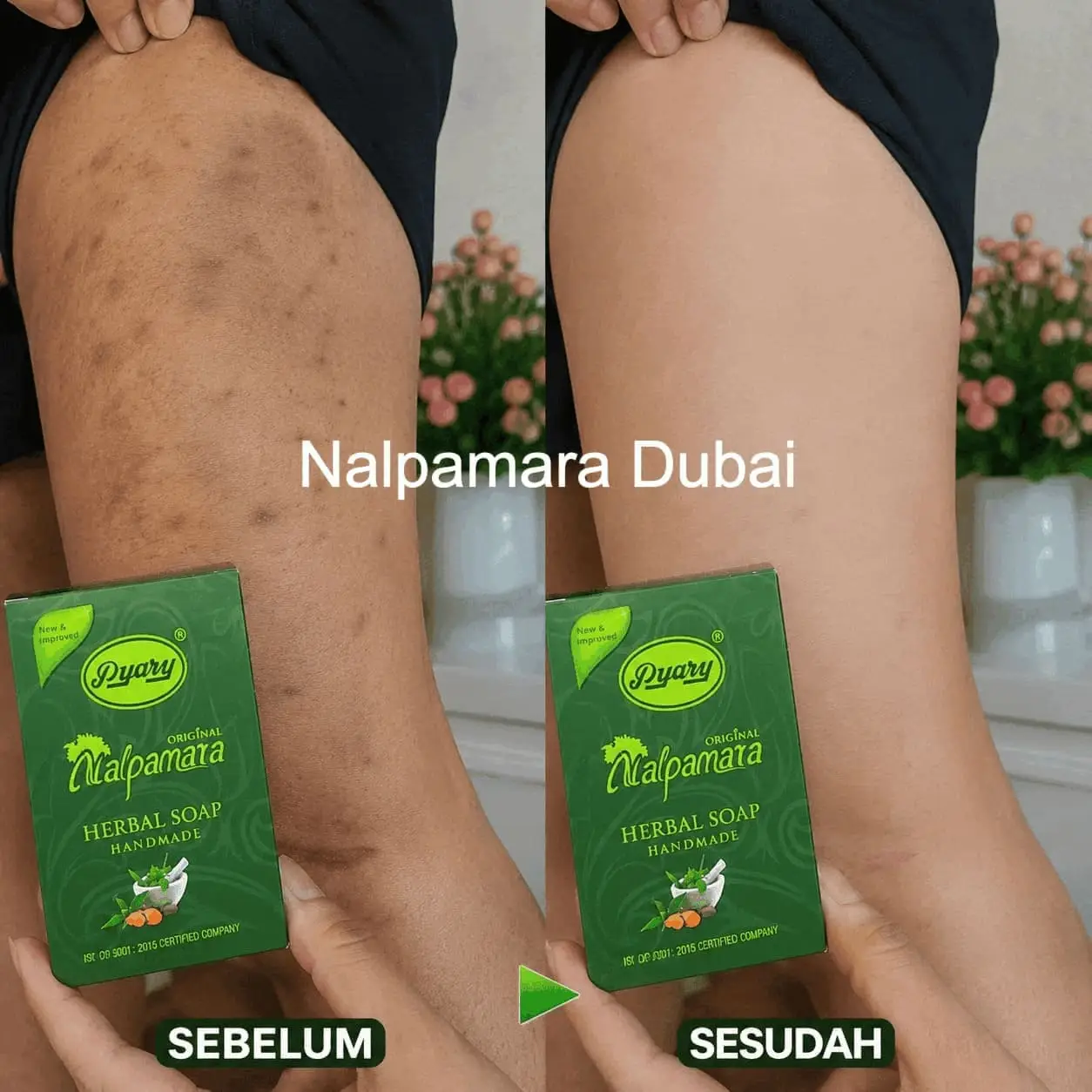 Before After Belang Bekas Luka