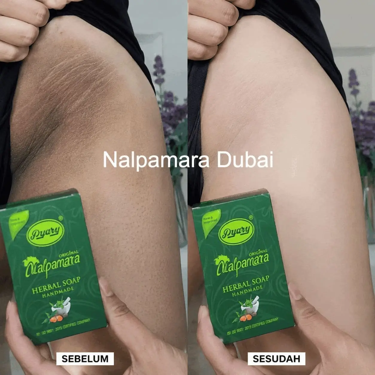 Before After Lipatan Gelap